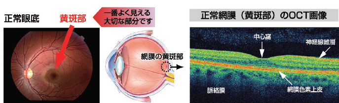 正常な眼球の断面像